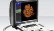 УЗИ аппарат SonoScape S6