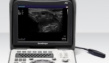 УЗИ аппарат SonoScape A6V